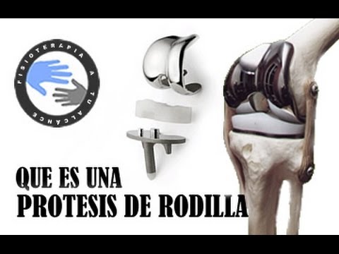 como funciona una protesis de rodilla