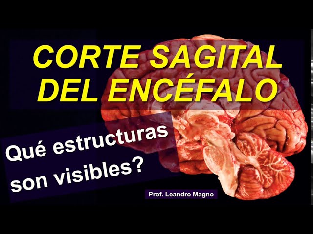 corte sagital del encefalo y sus partes