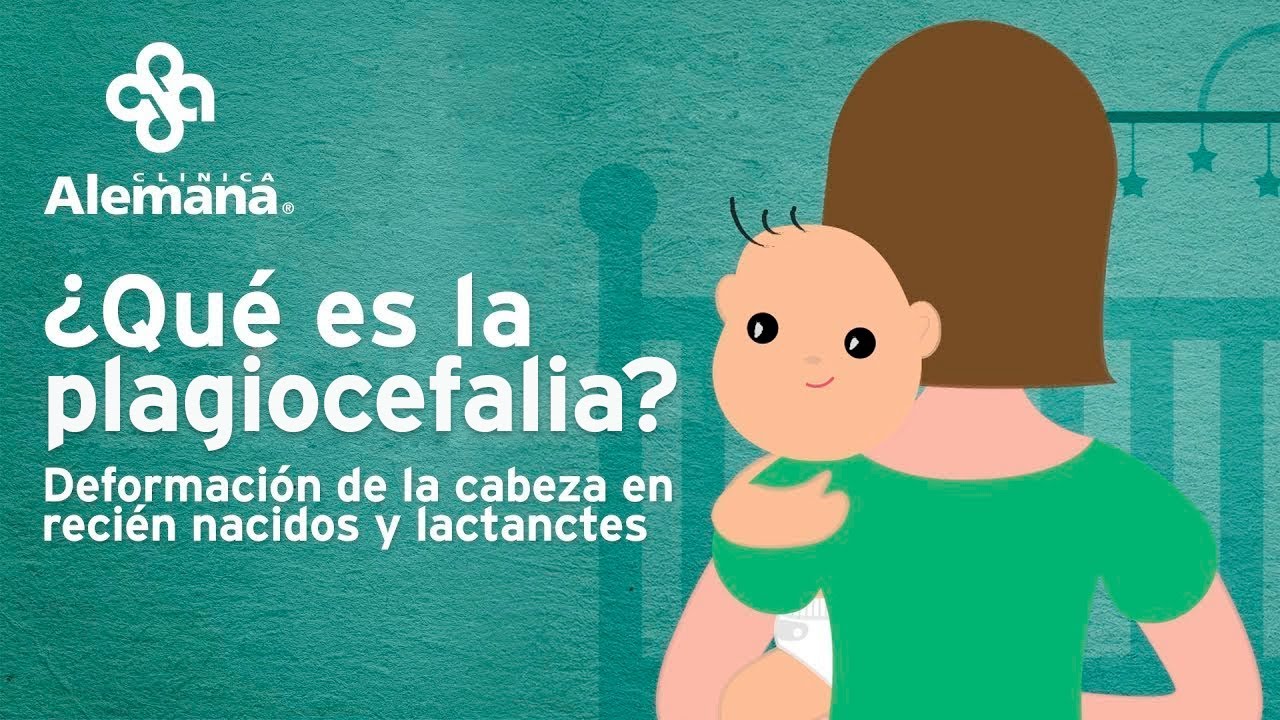 deformaciones en la cabeza del bebe