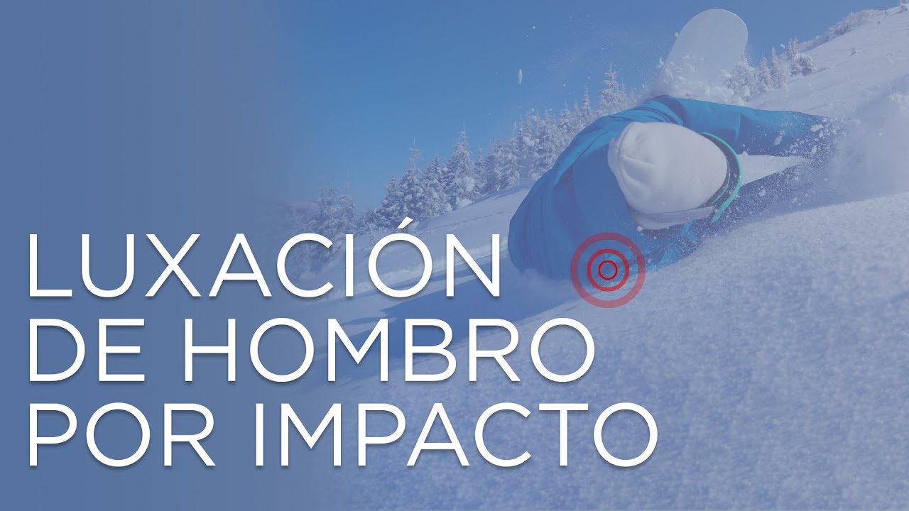 dolor de hombro despues de una caida