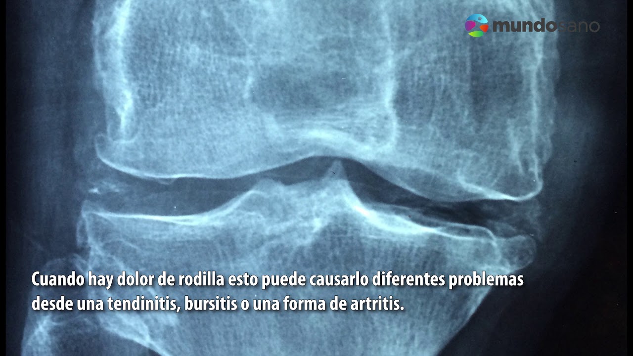 dolor de rodilla por la noche