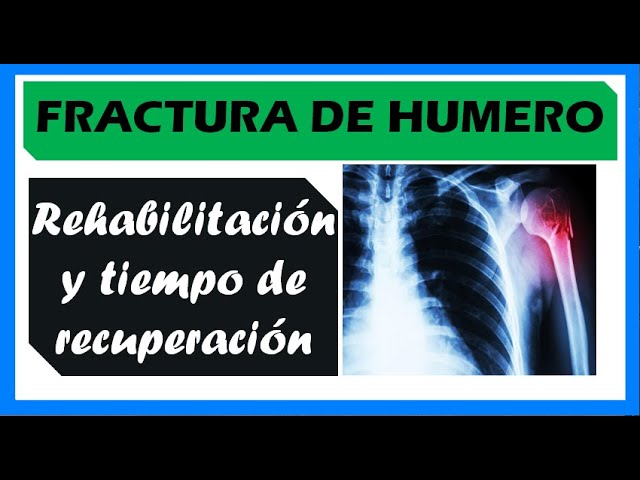 rotura de hombro tiempo de recuperacion
