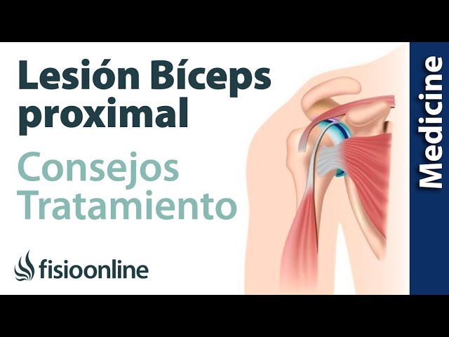tiempo de baja rotura tendón bíceps